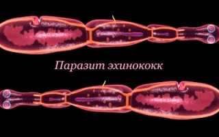 Что нельзя есть при эхинококкозе