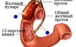 Причины, симптомы и лечение холецистита