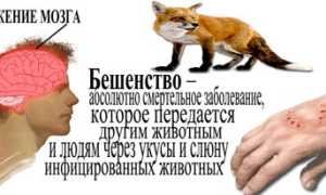 Симптомы и признаки бешенства у человека