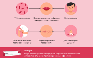 Кандидозный баланопостит лечение тридерм
