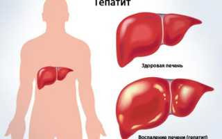 Симптомы и лечение гепатита, как передается
