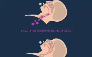 Как остановить храп