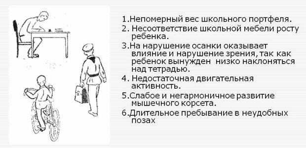 Причины сколиоза