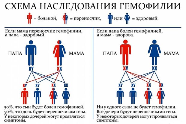 Схема наследования гемофилии 