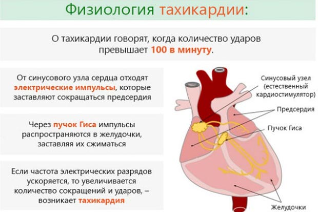 Физиологическая тахикардия