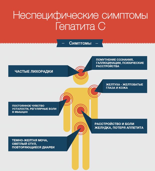 Симптомы гепатита С