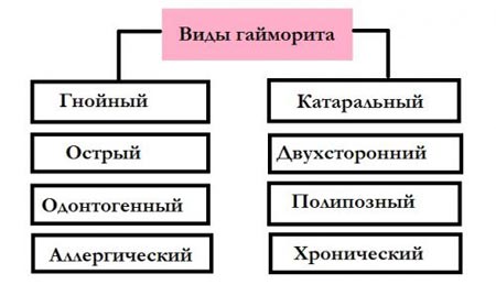 Виды гайморита