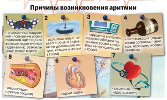 Причины возникновения аритмии 