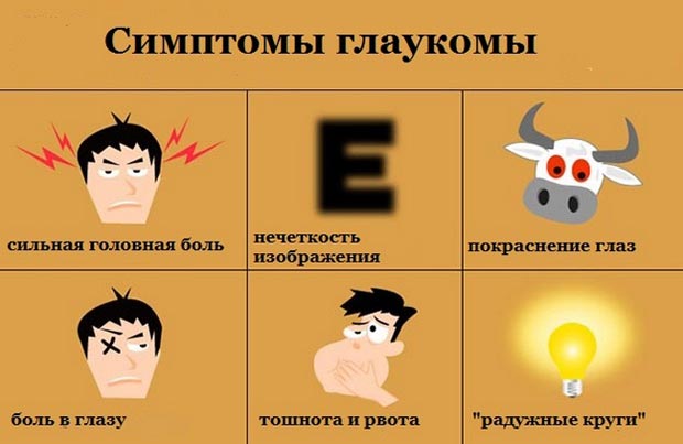 Симптомы глаукомы 