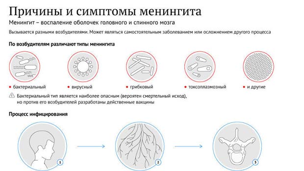 Причины менингита