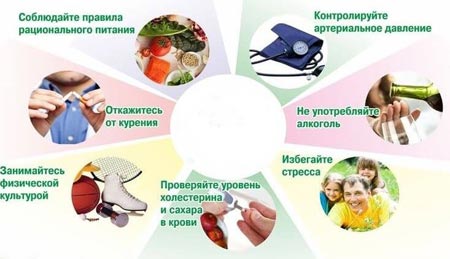 Профилактика инсульта