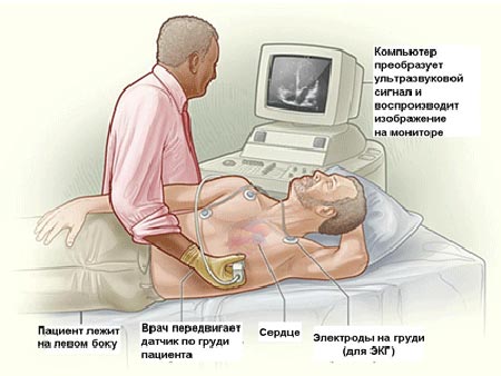 ЭхоКГ