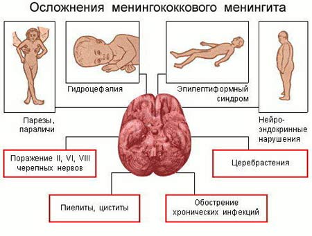 Осложнения менингита