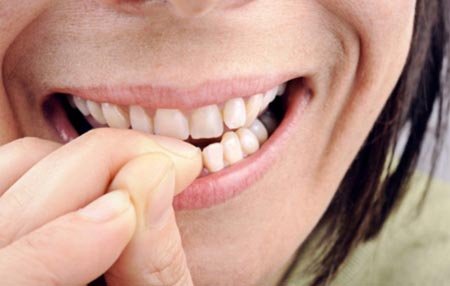 Пародонтоз