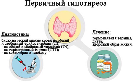 Диагностика и лечение гипотиреоза