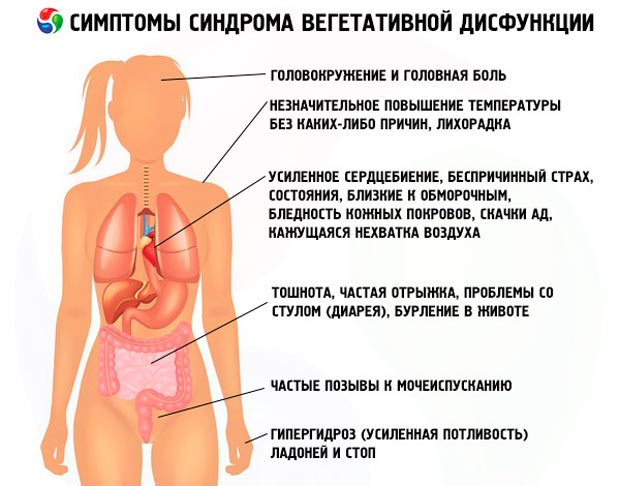Симптомы ВСД