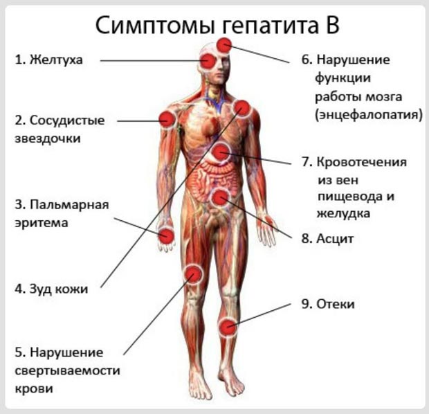Симптомы гепатита В