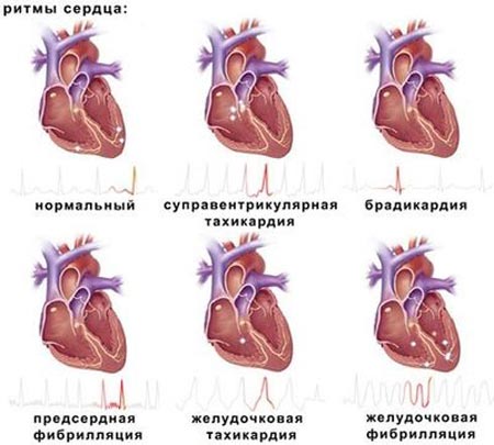 Ритмы сердца