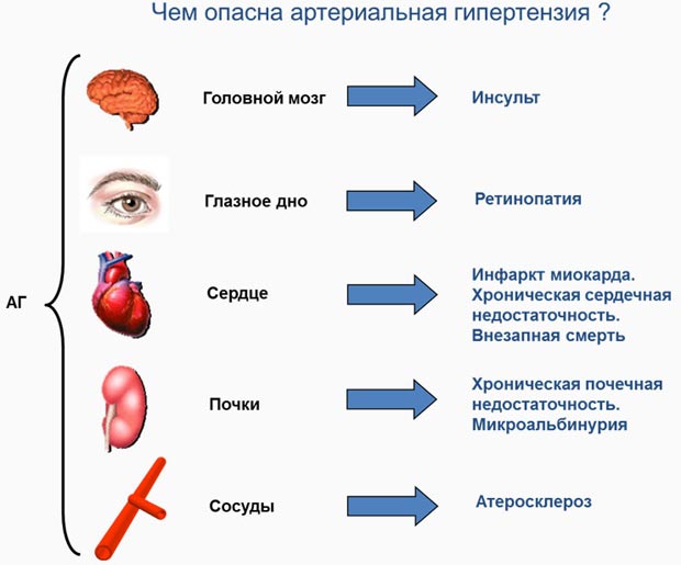 Чем опасна артериальная гипертензия 