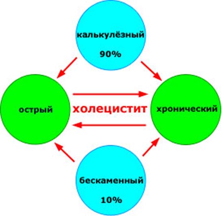 Классификация холецистита 