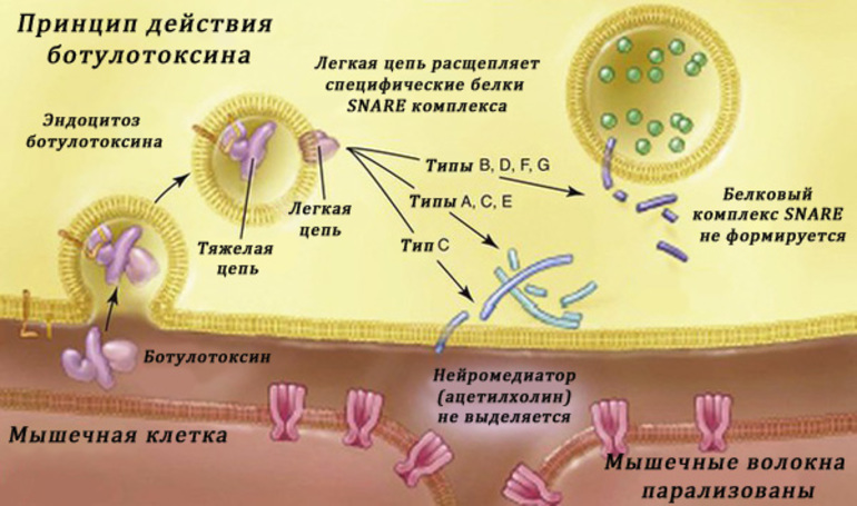 Действие ботокса