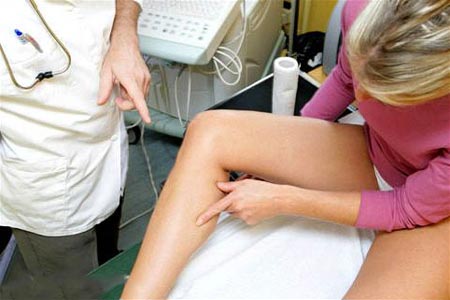 Физиотерапия при варикозе