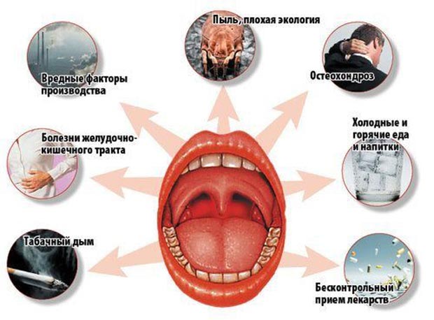 Причины ангины