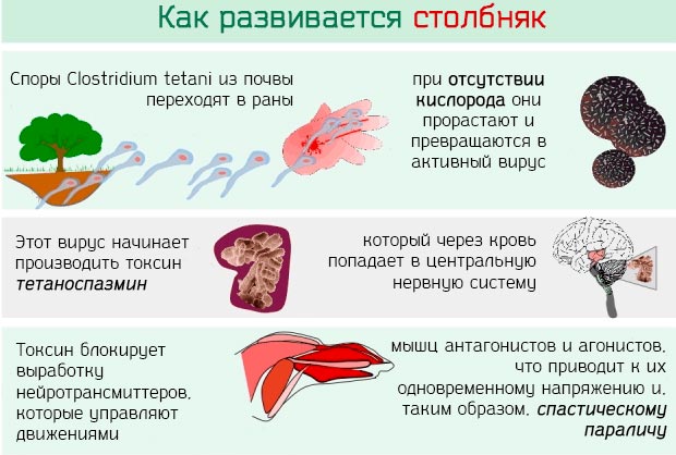 Развитие столбняка