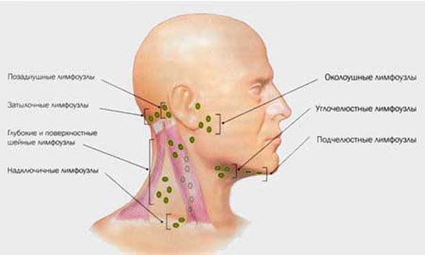 Виды лимфаденита