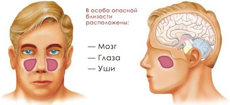 Осложнения при гайморите