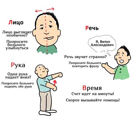 Симптомы инсульта