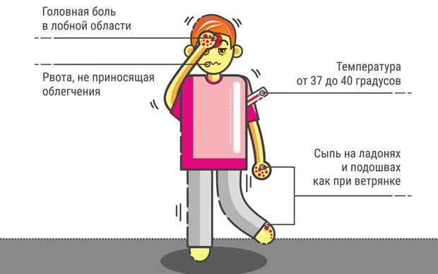 Симптомы менингита