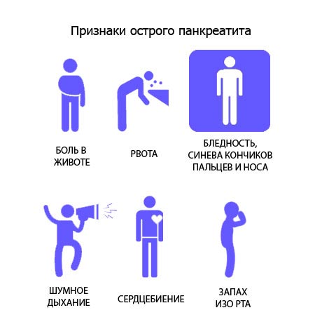 Признаки острого панкреатита 