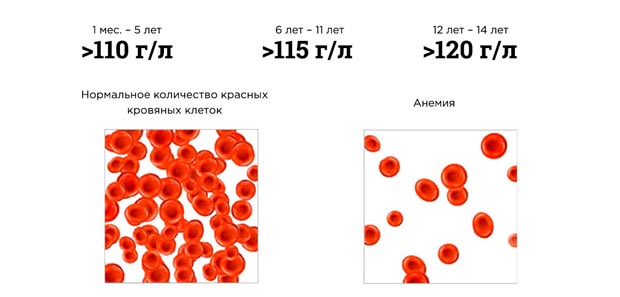Концентрация гемоглобина