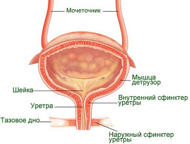 Шеечный цистит 