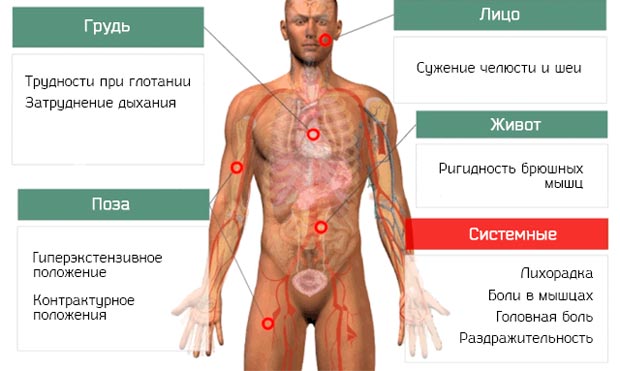 Симптомы стоблняка