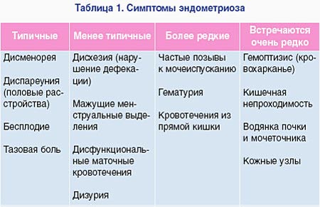Симптомы эндометриоза