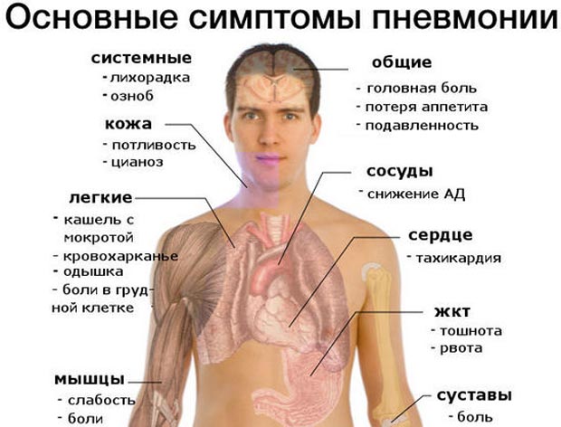 Симптомы пневмонии