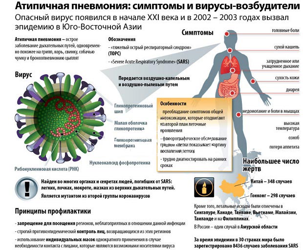 Атипичная пневмония 