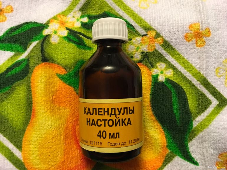 Способ избавиться от угрей