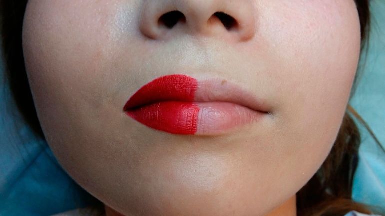 Как ухаживать за губами после процедуры