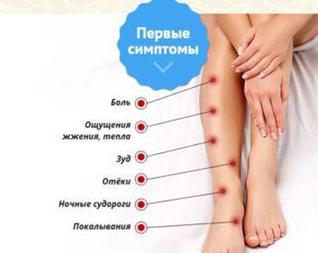 Симптомы тромбофлебита