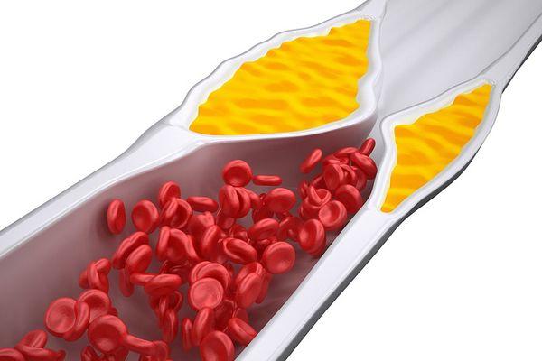 Холестерин