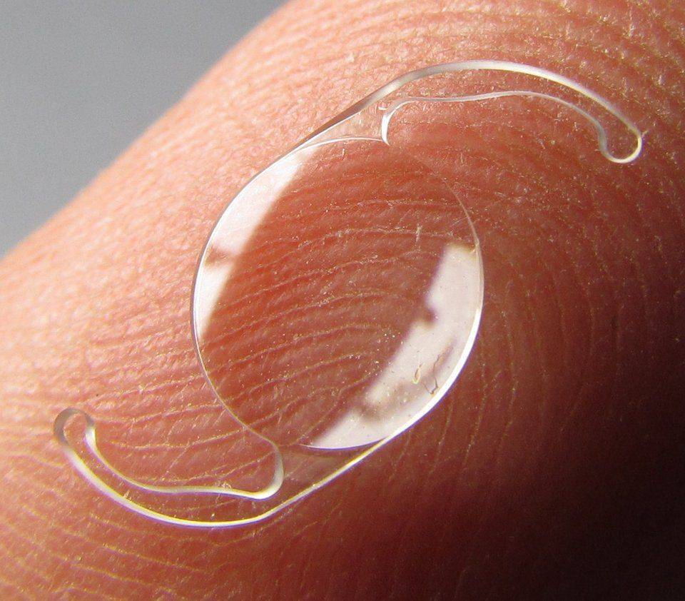 Интраокулярная линза Искусственная линза