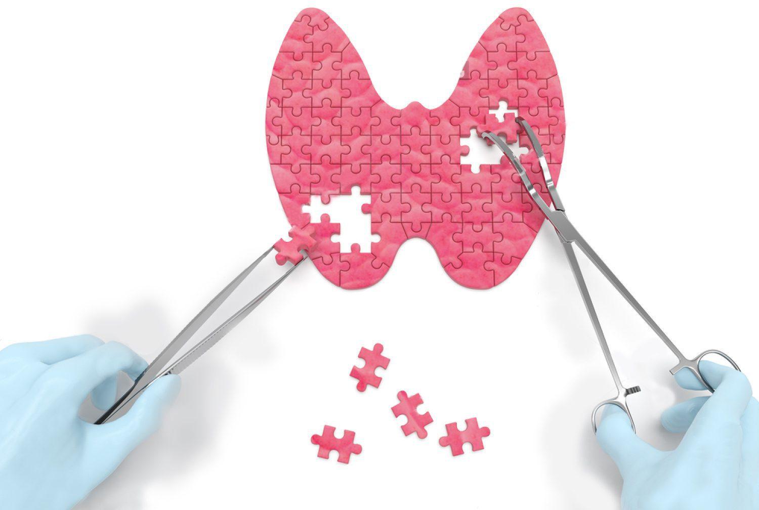 Щитовидная железа