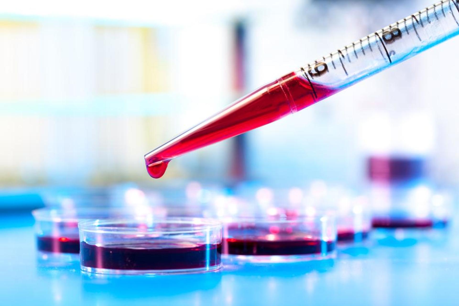 Анализ крови на пищевую непереносимость