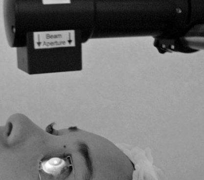 Операция на роговице глаза Кросслинкинг процедура