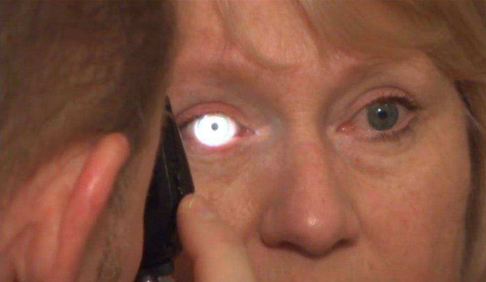 Диагностические действия Осмотр глаза