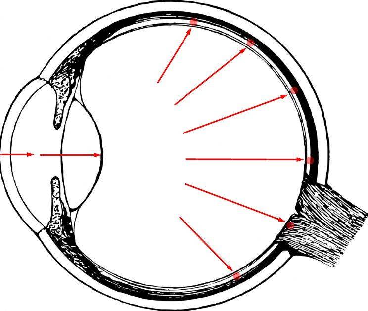 Давление в глазу Давление при глаукоме