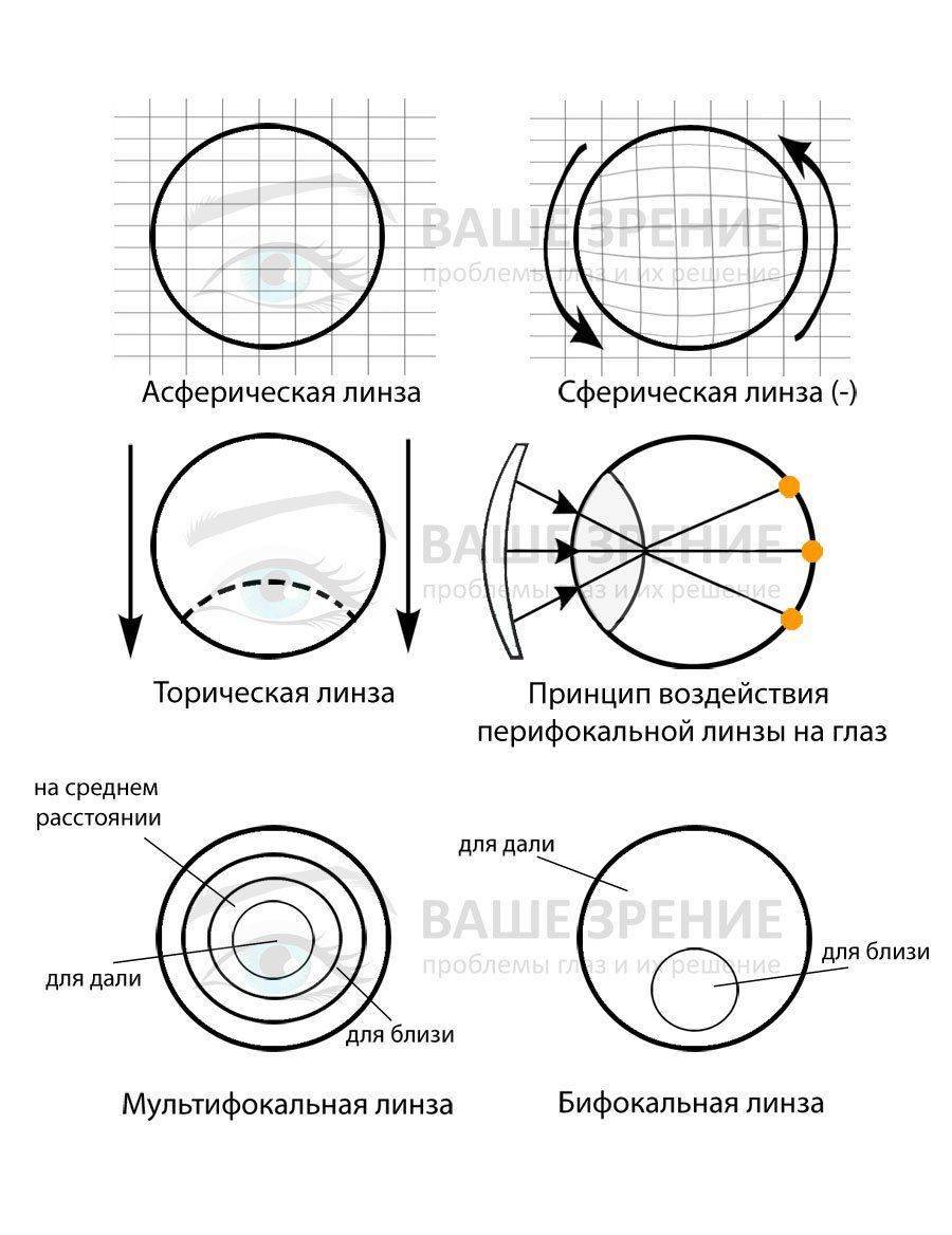 Какие бывают линзы Все типы линз
